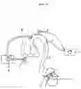 Fig. 05 - SIMULATOR FOR MAJOR SURGICAL OPERATIONS