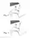 Fig. 04 - Devices and methods for collection, storage and transportation of biological specimens