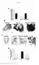 Fig. 06 - DIAGNOSTIC COMPOSITIONS AND TREATMENT METHODS FOR CONDITIONS INVOLVING TROPHOBLAST CELL DEATH, DIFFERENTIATION, INVASION AND/OR CELL FUSION AND TURNOVER