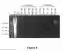 Fig. 09 - INCREASING GENOMIC INSTABILITY DURING PREMALIGNANT NEOPLASTIC PROGRESSION REVEALED THROUGH HIGH RESOLUTION ARRAY-CGH