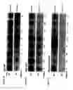 Fig. 02 - Steroid 5α-reductase