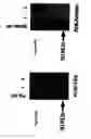 Fig. 06 - Steroid 5α-reductase