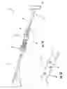 Fig. 02 - Intramedullary device assembly and associated method