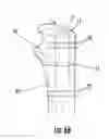 Fig. 09 - Intramedullary device assembly and associated method