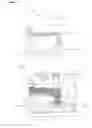 Fig. 02 - Artificial sphincter system