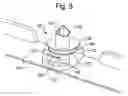Fig. 05 - Vehicle clip centering device and method