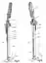 Fig. 02 - Arrangement for conveying concrete with a height-adjustable concrete distributing mast
