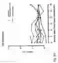 Fig. 17 - IMMUNOMODULATION FOR AUTOIMMUNE TYPE-2 DIABETES