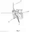 Fig. 02 - Implantable sensor lead