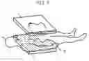 Fig. 06 - X-ray moving image radiographing apparatus