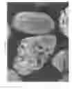 Fig. 06 - Controlled release agricultural products and processes for making the same
