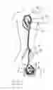 Fig. 02 - Expandable catheter for delivery of fluids