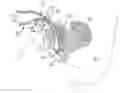 Fig. 01 - Adjustable Sling and Method of Treating Pelvic Conditions