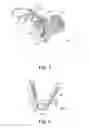 Fig. 03 - Adjustable Sling and Method of Treating Pelvic Conditions