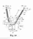 Fig. 07 - Adjustable Sling and Method of Treating Pelvic Conditions