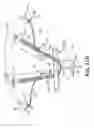 Fig. 09 - Adjustable Sling and Method of Treating Pelvic Conditions