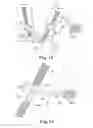 Fig. 10 - Adjustable Sling and Method of Treating Pelvic Conditions