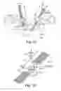 Fig. 12 - Adjustable Sling and Method of Treating Pelvic Conditions