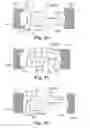 Fig. 13 - Adjustable Sling and Method of Treating Pelvic Conditions