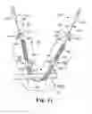 Fig. 22 - Adjustable Sling and Method of Treating Pelvic Conditions