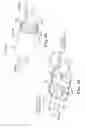 Fig. 24 - Adjustable Sling and Method of Treating Pelvic Conditions