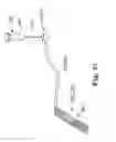Fig. 27 - Adjustable Sling and Method of Treating Pelvic Conditions