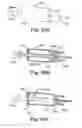 Fig. 33 - Adjustable Sling and Method of Treating Pelvic Conditions