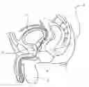 Fig. 01 - ARTIFICIAL SPHINCTER WITH PIEZOELECTRIC ACTUATOR