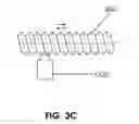 Fig. 07 - ARTIFICIAL SPHINCTER WITH PIEZOELECTRIC ACTUATOR