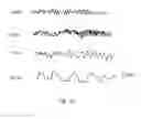 Fig. 02 - Method and system for analyzing and presenting an electroencephalogram (EEG)