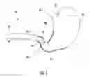 Fig. 02 - Pyloric valve devices and methods