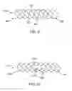 Fig. 07 - Side branch stent having a proximal split ring