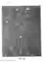 Fig. 08 - Materials for enhancing the durability of earth-boring bits, and methods of forming such materials