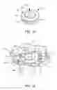 Fig. 09 - Lockable torque-limiting driver and method