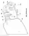 Fig. 02 - Multipurpose therapeutic face mask