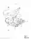 Fig. 02 - Fluid pumping ventricular assist device and components with static seal