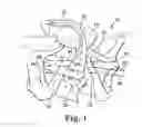 Fig. 02 - Methods and apparatus for securing and tensioning a urethral sling