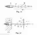 Fig. 09 - Methods and apparatus for securing and tensioning a urethral sling