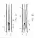 Fig. 16 - Method of treating a blood vessel with an optical fiber having a spacer