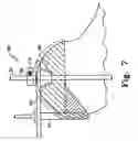 Fig. 09 - Humeral rotating burr guide