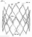 Fig. 01 - Combination barb restraint and stent attachment deployment mechanism