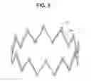 Fig. 09 - Combination barb restraint and stent attachment deployment mechanism