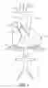 Fig. 02 - Endovascular Prosthesis for Ascending Aorta