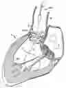 Fig. 01 - Everting heart valve