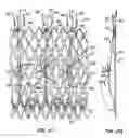 Fig. 02 - Everting heart valve