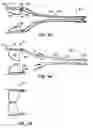 Fig. 07 - Everting heart valve