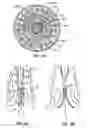Fig. 23 - Everting heart valve