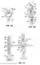 Fig. 25 - Everting heart valve