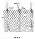 Fig. 30 - Everting heart valve