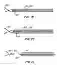 Fig. 32 - Everting heart valve